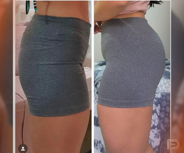 Prancheta 1 copiar 10