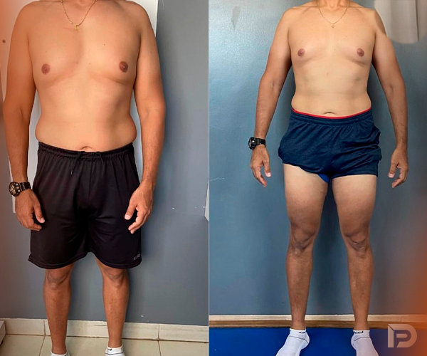 Prancheta 1 copiar 2