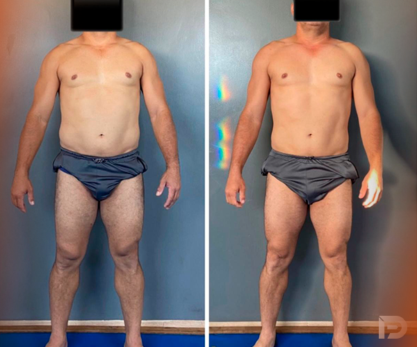 Prancheta 1 copiar 9